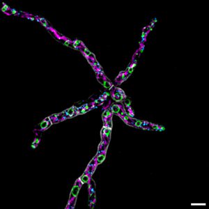 ImageJ=1.53f
unit=micron